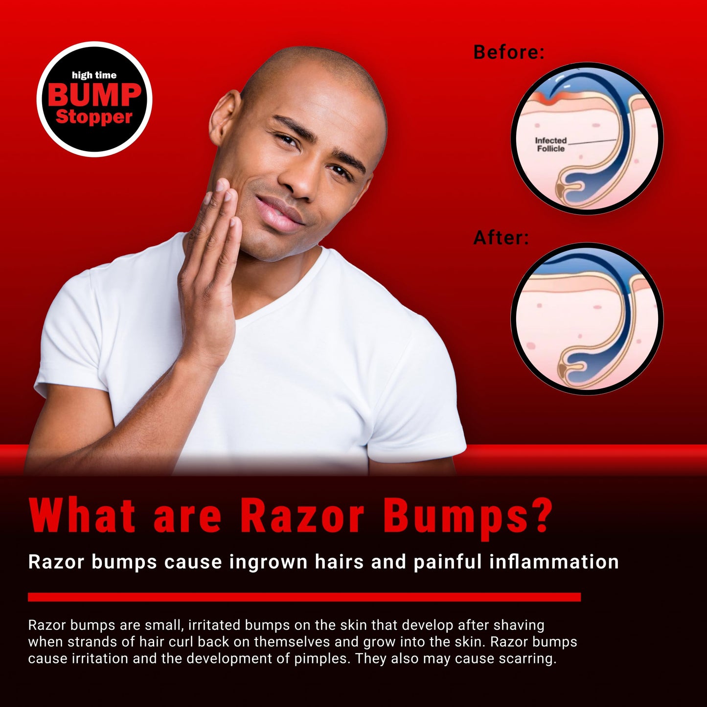 high time Bump Stopper 2 Double Strength Razor Bump Treatment | Formulated to Relieve Razor Burn | Eliminates Ingrown Hairs | Aftershave for Men - 0.5 OZ